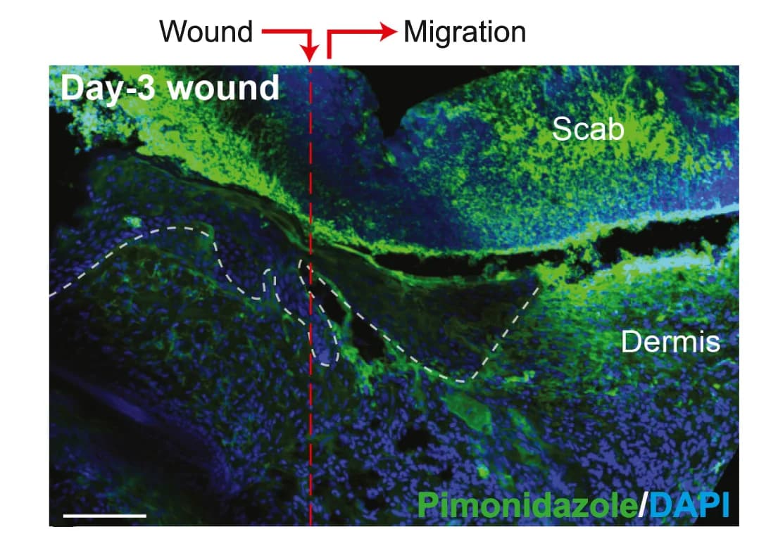 Open access visualization of Microscopy, Sagittal Section, Wound, Pimonidazole, Tissue Hypoxia