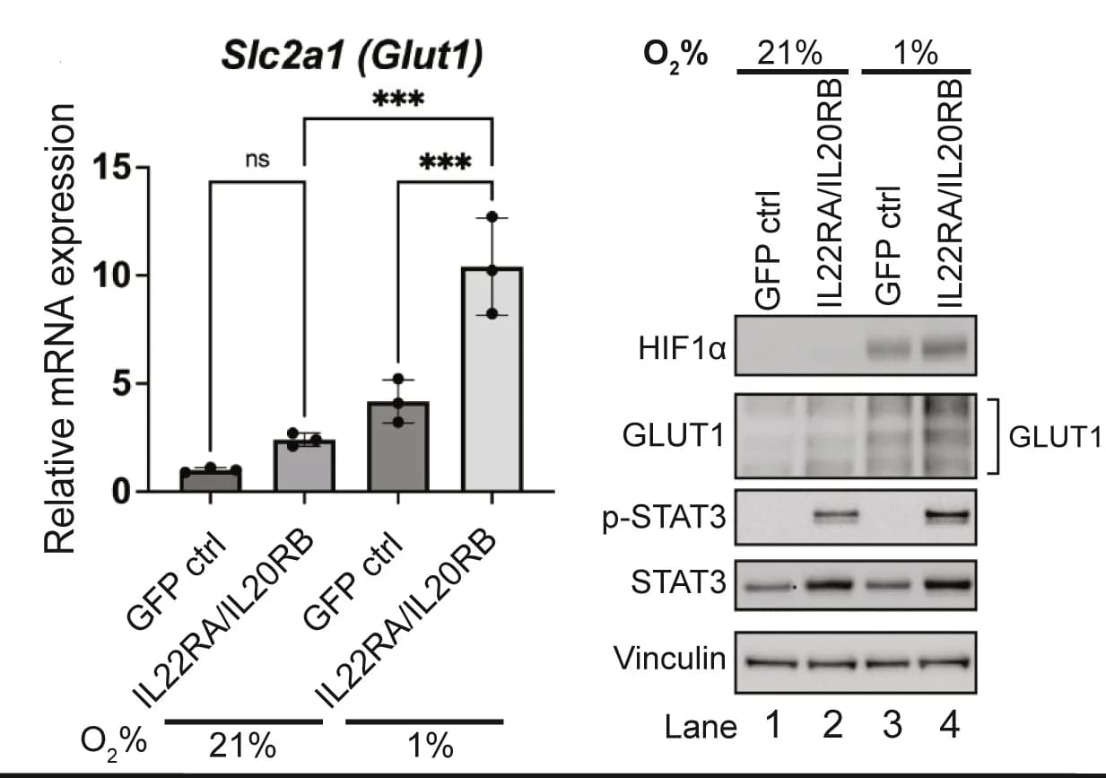 Open access visualization of Bar Plot, Error Bars, Gel, GLUT1 expression, Hypoxia