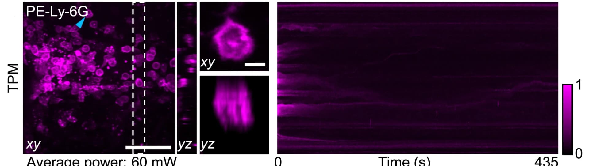 Open access visualization of Microscopy, Neutrophils, Mice Cortex, TPM