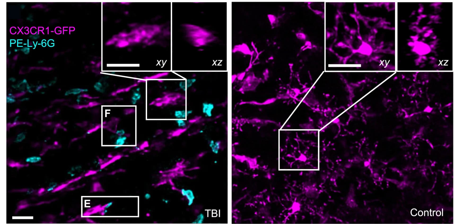 Open access visualization of Microscopy, Neutrophils, CX3CR1-positive Microglia/Macrophages/Monocytes, Microglia, Macrophages