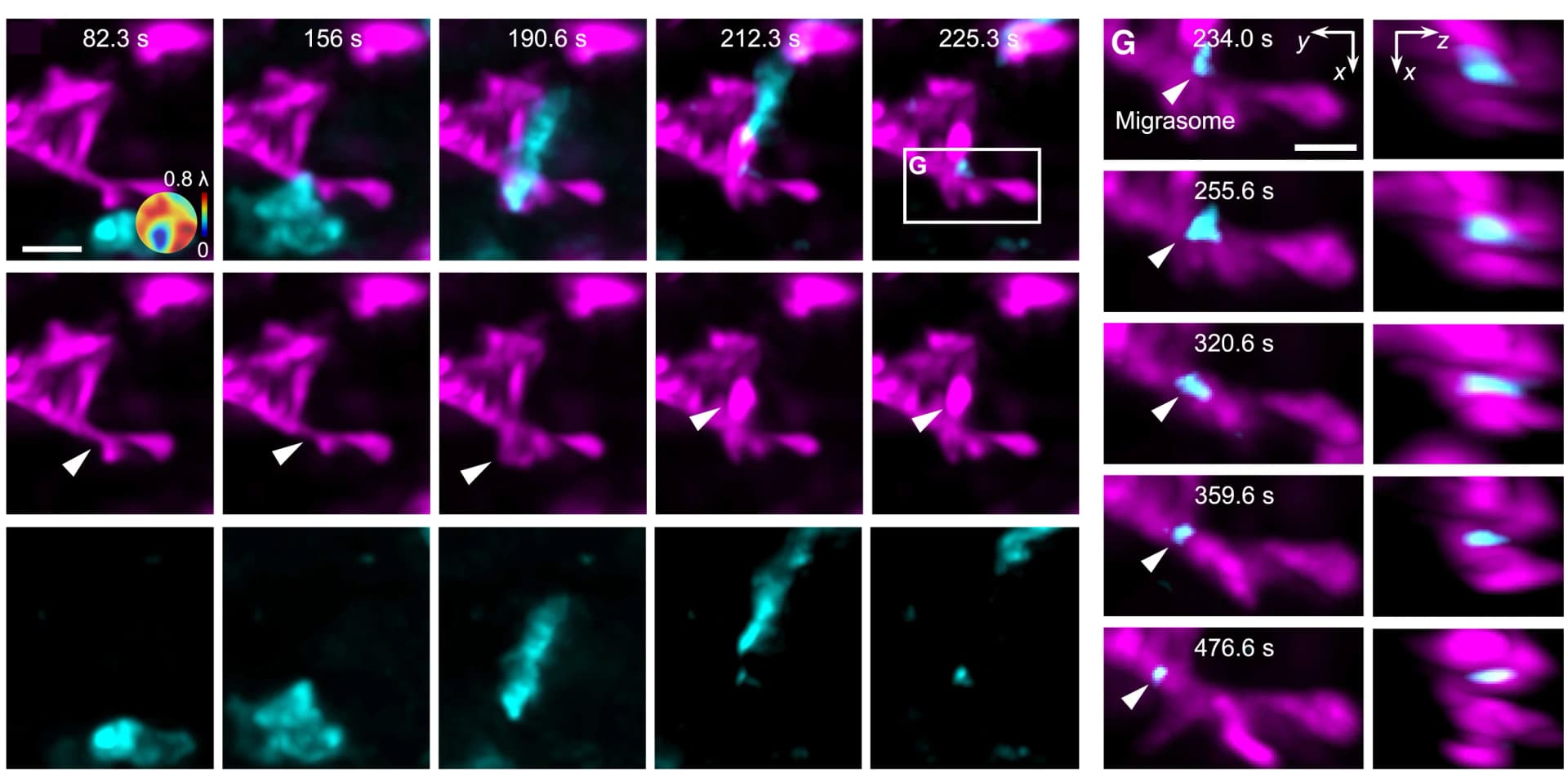 Open access visualization of Microscopy, Neutrophil, Migrasome, Microglia, TBI