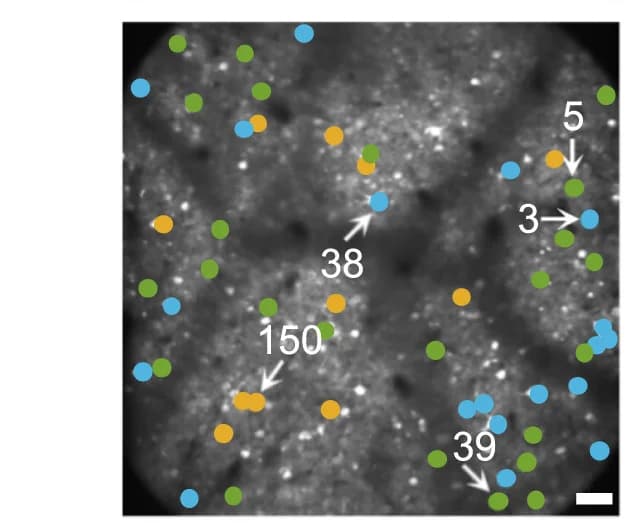 Open access visualization of Microscopy, Spatial Distribution, Neurons, ANOVA, Statistical Significance