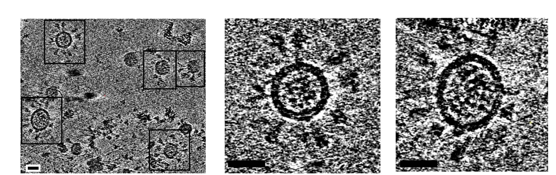 Open access visualization of Microscopy, Tomographic Slices, S-EABR eVLPs, Cryo-ET Imaging, Cell Culture Supernatants