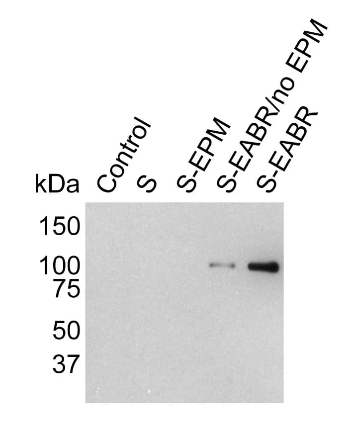 Open access visualization of Gel, Western Blot Analysis, eVLPs, Ultracentrifugation, Sucrose Cushion