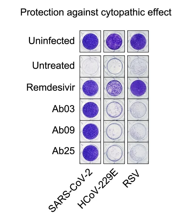 Open access visualization of Photo, NCI-H1975 Cells, TMEM106B-specific antibodies, Remdesivir, SARS-CoV-2