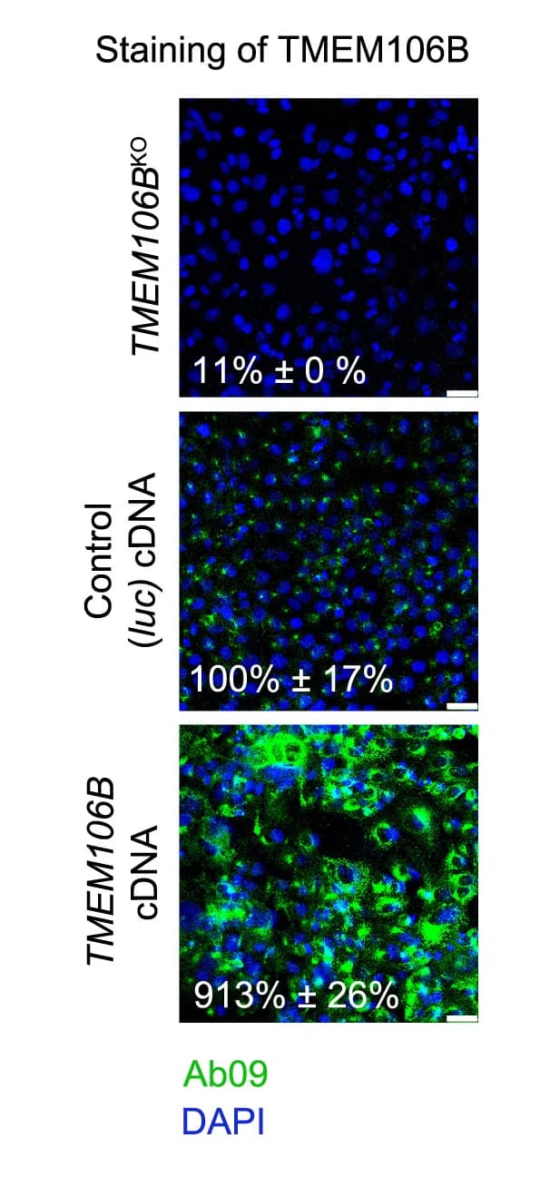 Open access visualization of Microscopy, MonoclonalTMEM106BKO, Wild-type NCI-H1975 Cells, Luciferase, TMEM106BcDNA