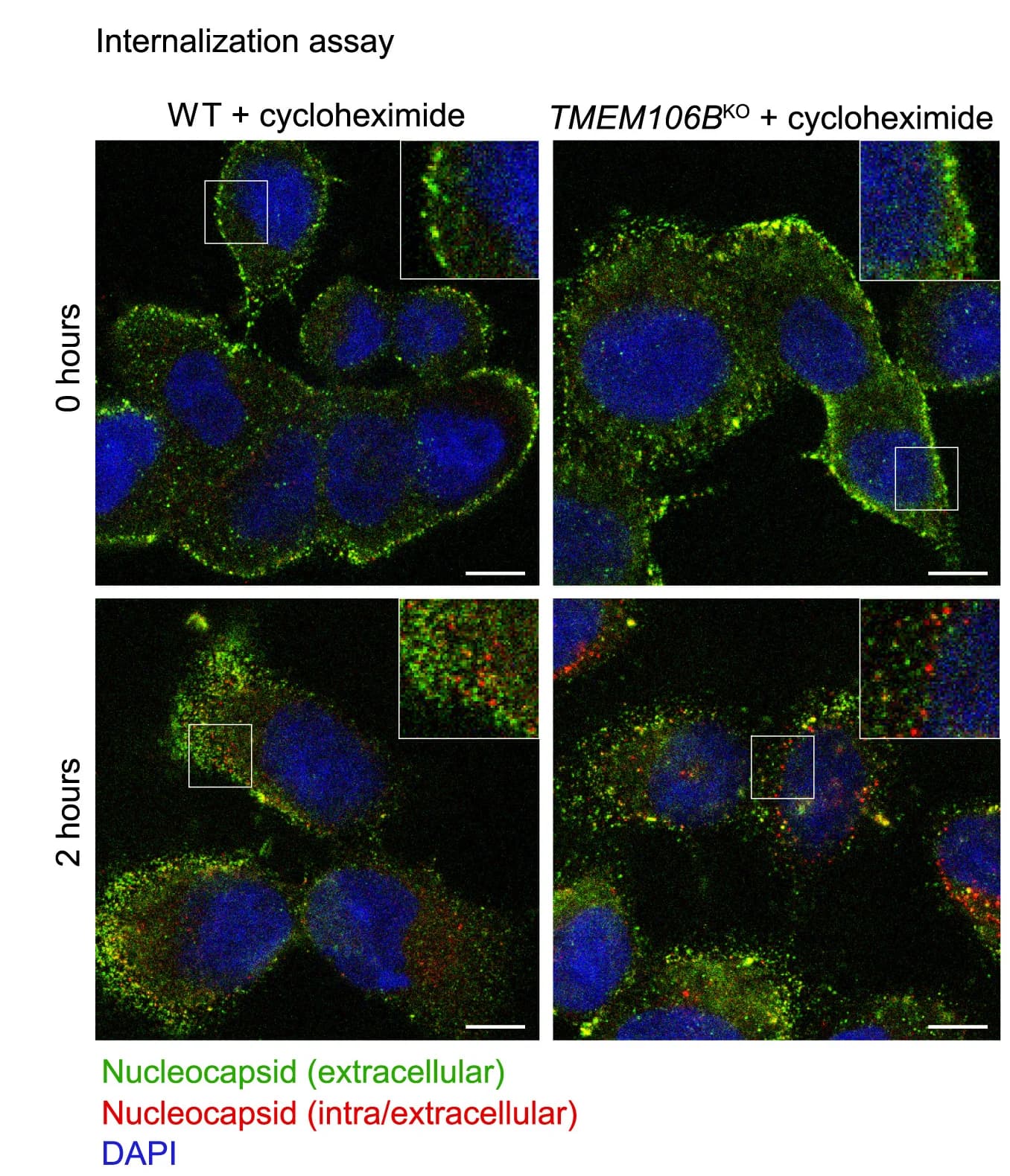 Open access visualization of Microscopy, NCI-H1975 WT cells, Monoclonal TMEM106B KO cells, SARS-CoV-2, Cycloheximide