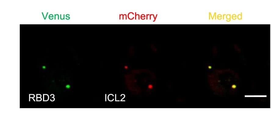 Open access visualization of Microscopy, Co-localization, RBD3, ICL2, Venus