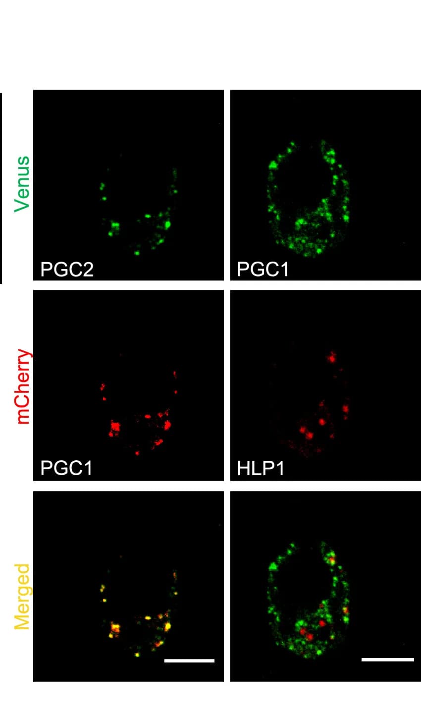 Open access visualization of Microscopy, Co-localization, PGC1-mCherry, PGC2-Venus