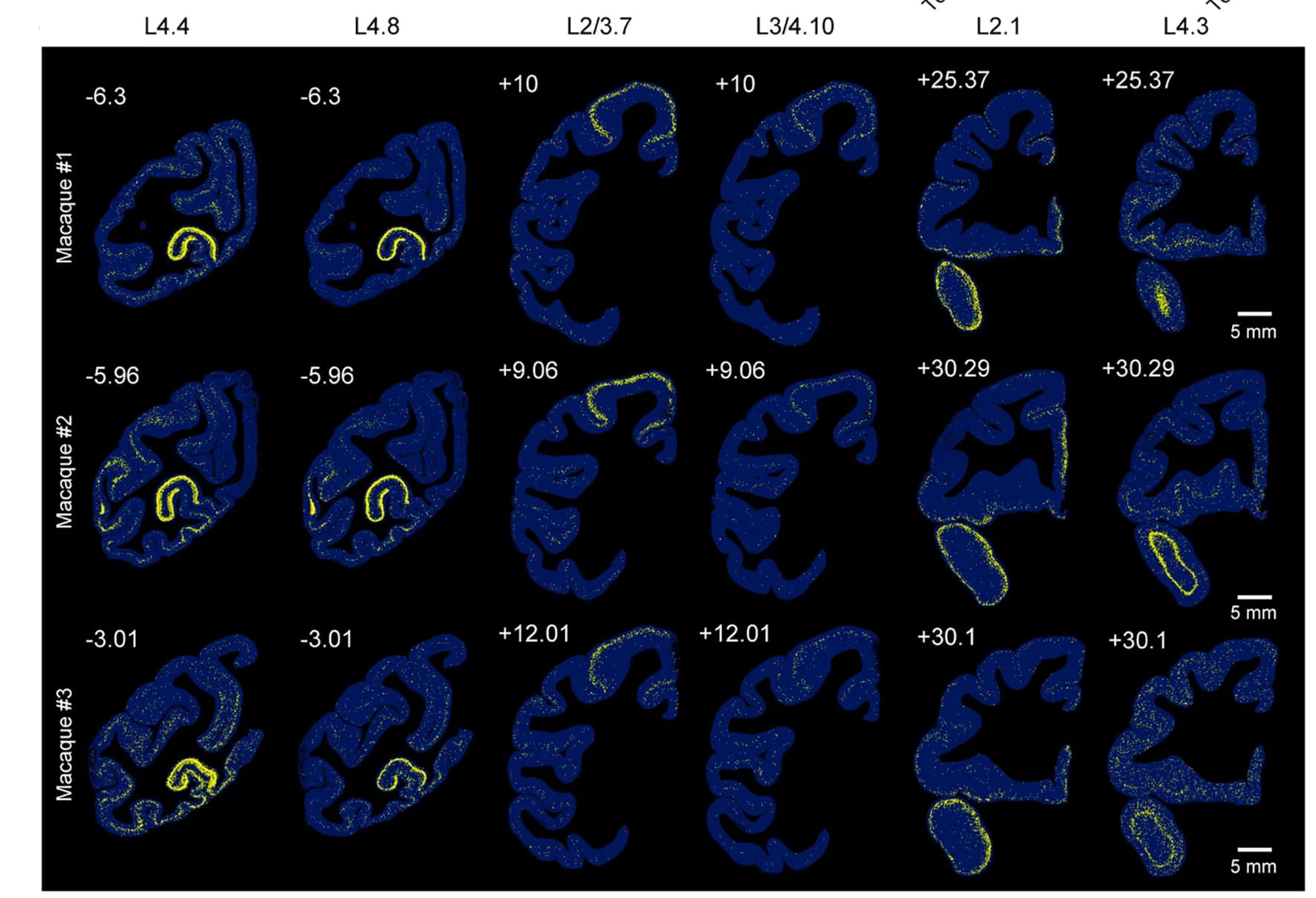 Open access visualization of Microscopy, Glutamatergic Cell Type, Regional Localization, Visual Cortex, Frontal Cortex