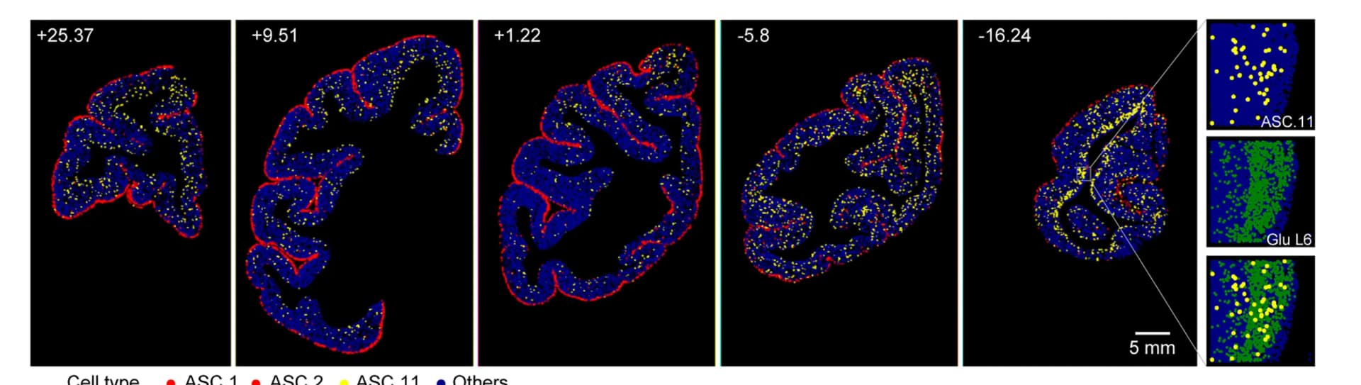 Open access visualization of Scatter Plot, Spatial Distribution, ASC types, Cortical Sections