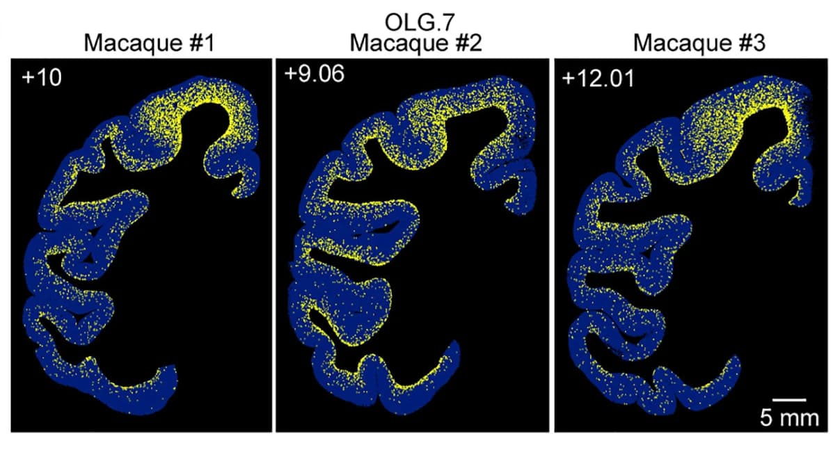 Open access visualization of Microscopy, Images, OLG Cells, Representative Sections