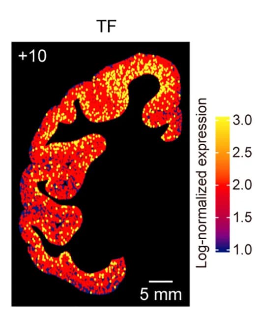 Open access visualization of Heatmap, Images, Marker Gene, Representative Sections