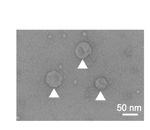 Open access visualization of Microscopy, RNA Exporters, Virus-Like Particles, Electron Microscopy, Cell Culture Supernatant