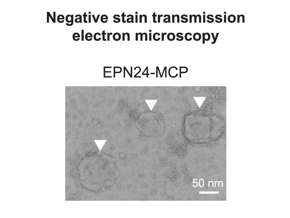 Open access visualization of Microscopy, Cells, EPN24-MCP, Vesicle, Electron Microscopy
