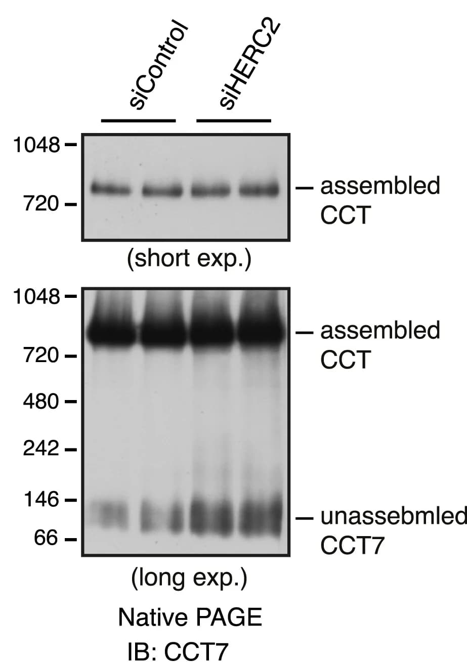 Open access visualization of Gel, MCF7 cells, siRNAs, Cytosolic extracts, Native PAGE