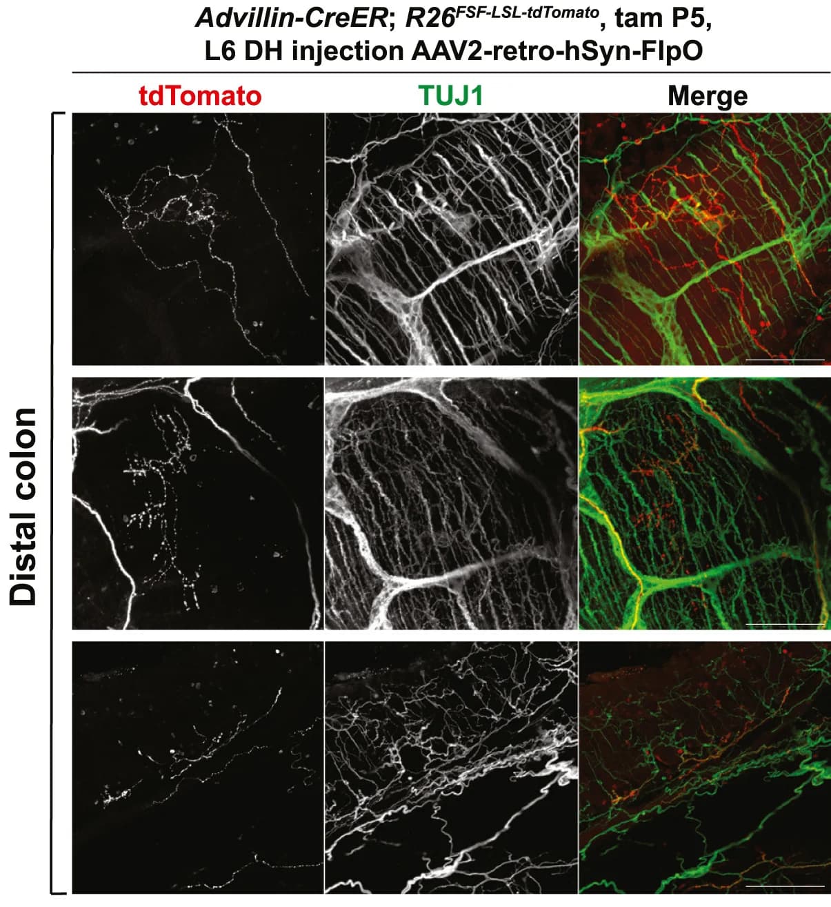 Open access visualization of Microscopy, AAV2-retro-hSyn-FlpO Virus, L6 Dorsal Horn, Advillin-CreER, R26FSF-LSL-tdTomato Mice