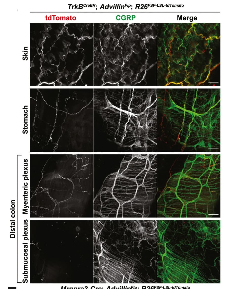 Open access visualization of Microscopy, Whole-mount immunostaining, Stomach, TrkBCreER;AdvillinFlp;R26FSF-LSL-tdTomatomice