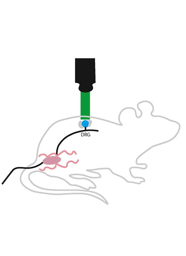 Open access visualization of Illustration, DRG, Calcium Imaging, Schematic