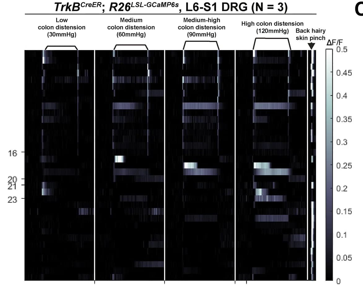 Open access visualization of Heatmap, In Vivo, DRG, Calcium Imaging, Colon Distension