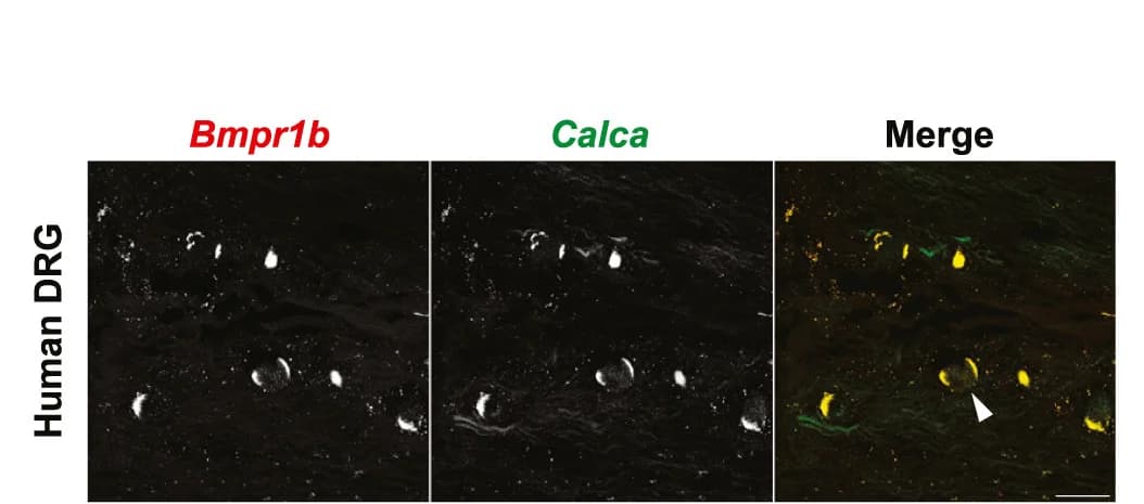 Open access visualization of Microscopy, In Situ Hybridization, Human DRG, Calca+ DRG Neurons, Bmpr1b+