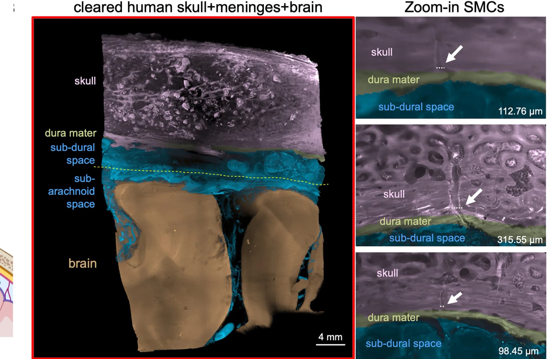 Open access visualization of Microscopy, Light-Sheet Microscopy, Cleared Tissue, Skull-Meninges Channels, Skull Bone Marrow