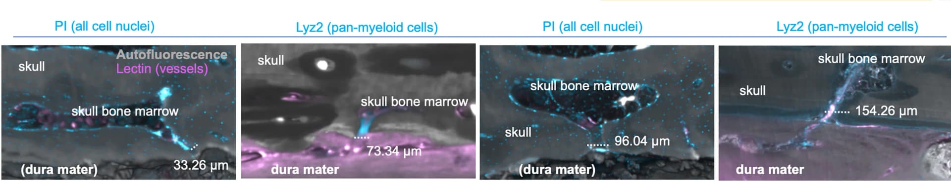 Open access visualization of Microscopy, Skull-Meninges-Channels, Autofluorescence, Lectin, Propidium Iodide