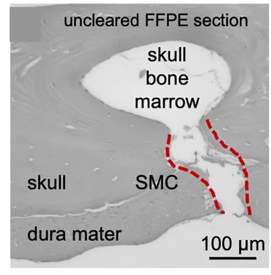 Open access visualization of Microscopy, Smooth Muscle Cells, FFPE, Skull-Dura Section
