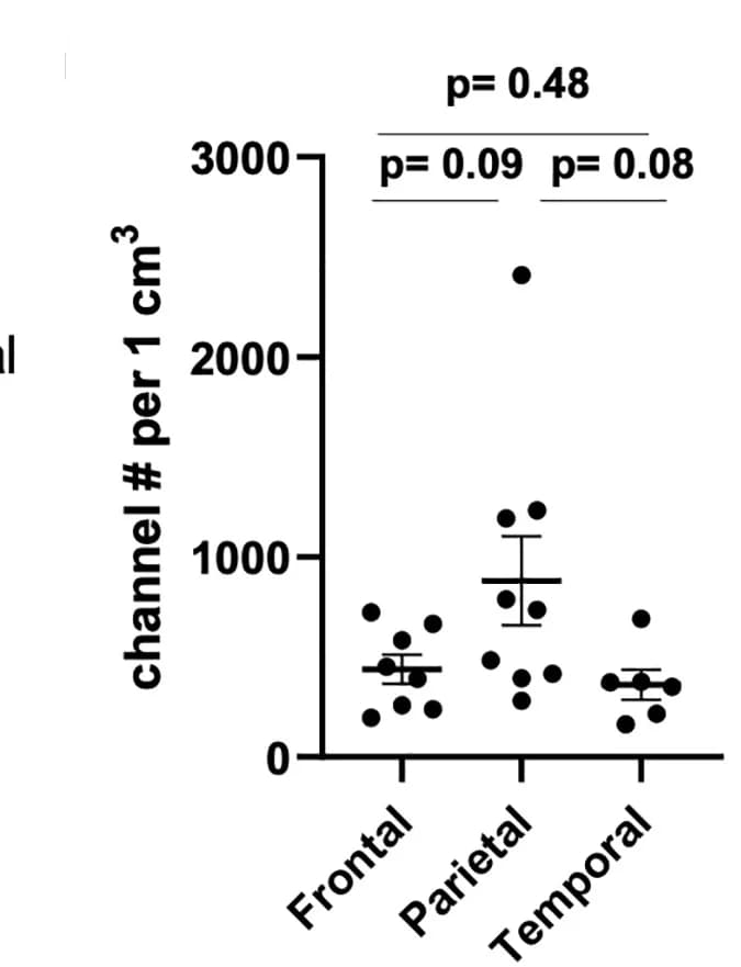 Open access visualization of Scatter Plot, Channel Numbers, Frontal Region, Parietal Region, Temporal Region