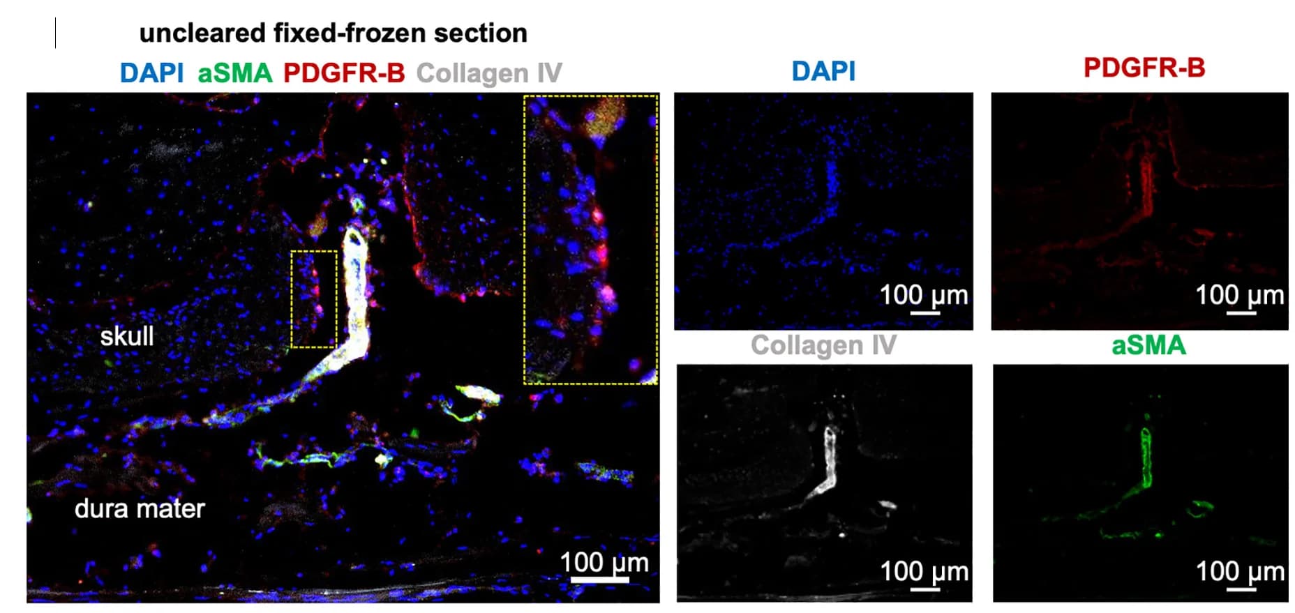 Open access visualization of Microscopy, Smooth Muscle Cells, Artery, Skull, Skull-Dura Section