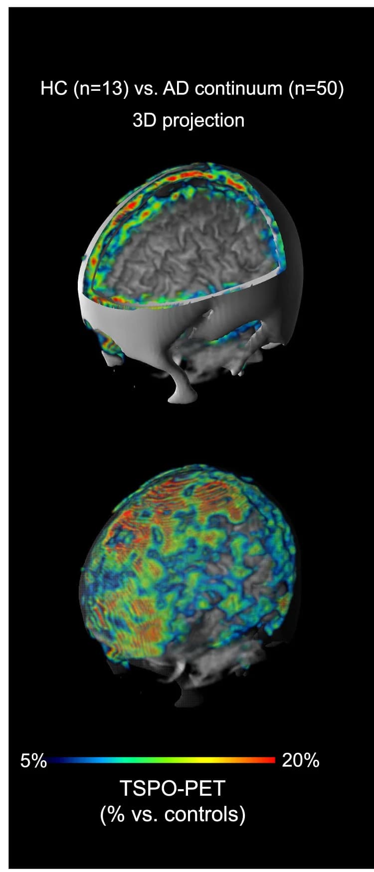 Open access visualization of 3D Plot, 3D Surface Projection, CT, MRI, TSPO-PET