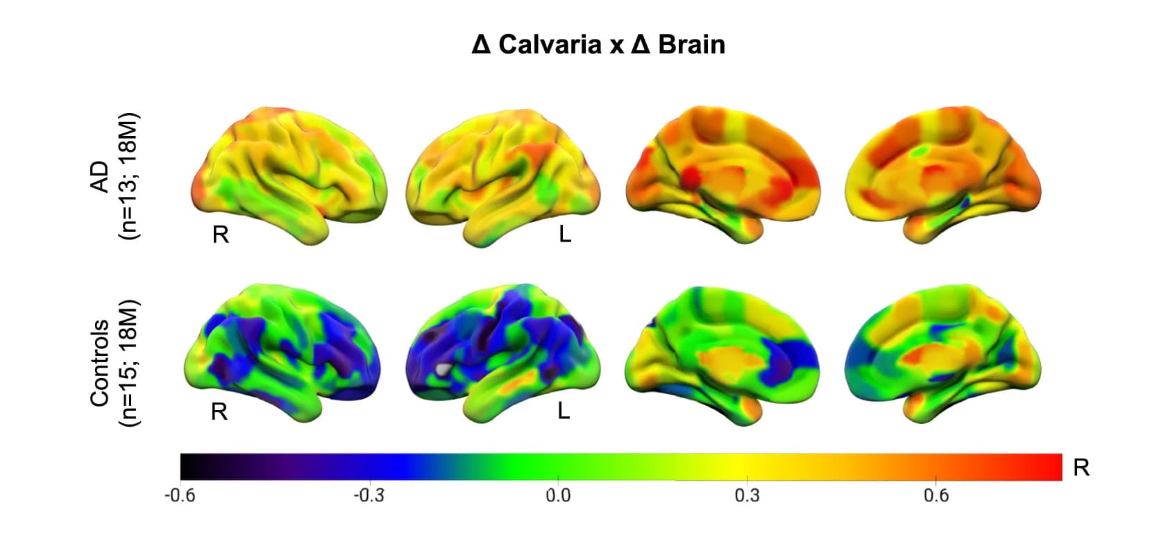 Open access visualization of Heatmap, Brain Surface Projections, Regional Correlations, TSPO-PET Changes, Alzheimer’s Disease