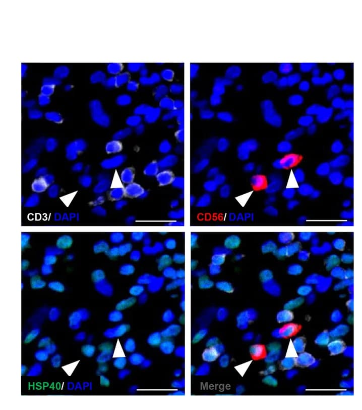 Open access visualization of Microscopy, HCC Tumor, Multiplex Immunofluorescence, TaNK Cells