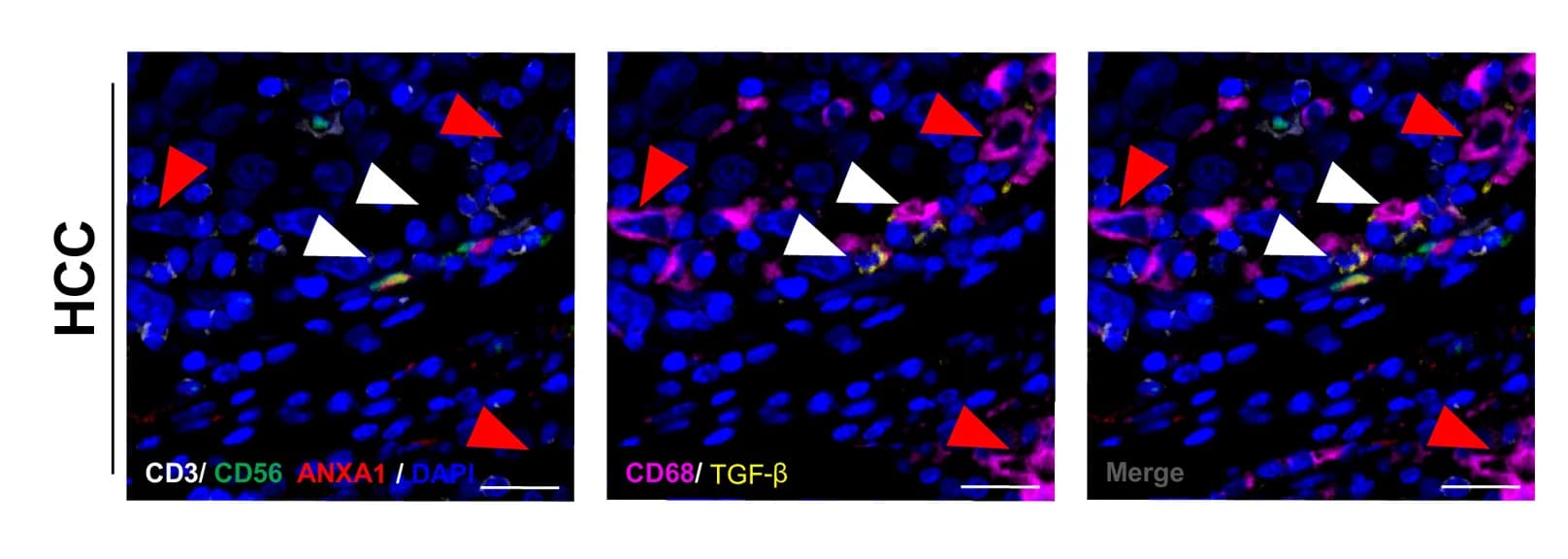 Open access visualization of Microscopy, Representative Images, Fluorescence Intensity, TGF-β Expression, Macrophages