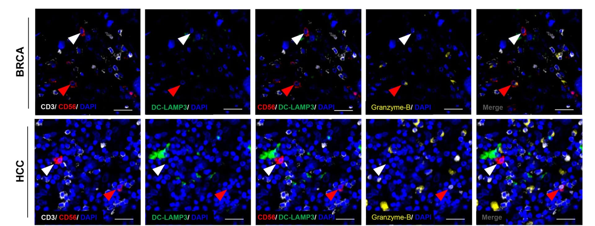 Open access visualization of Microscopy, Multiplex Immunofluorescence, Co-localization, LAMP3+DCs, DC-LAMP3+