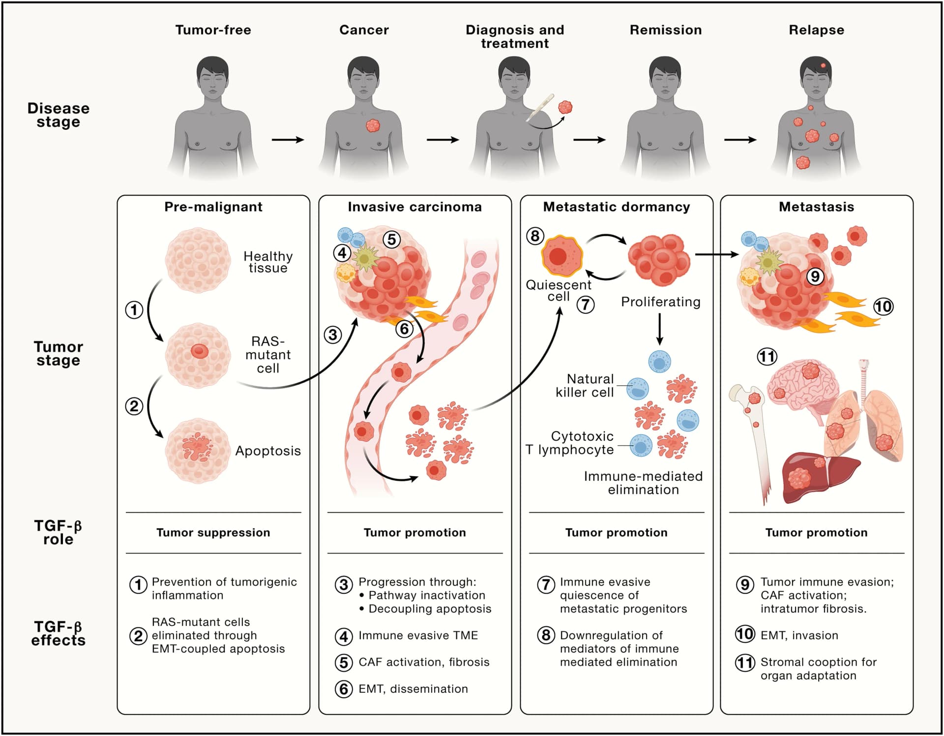 Open access visualization of Workflow, Illustration, TGF-β, Carcinogenesis, Tumor microenvironment