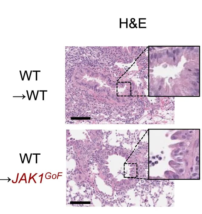 Open access visualization of Microscopy, Lung Histology, Chimeric Mice, WT -> WT, WT -> JAK1GoF