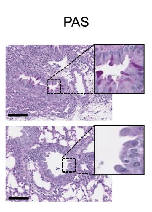 Open access visualization of Microscopy, Lung Histology, Chimeric Mice, WT -> WT, WT -> JAK1GoF