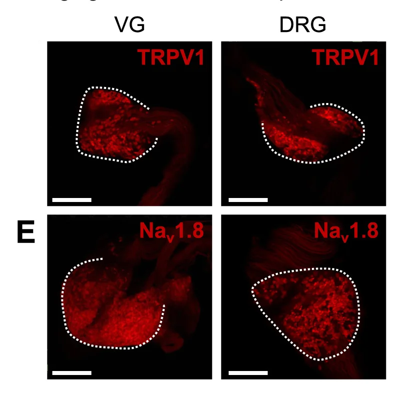 Open access visualization of Microscopy, Nociceptive Markers, TRPV1, Nav1.8, VG