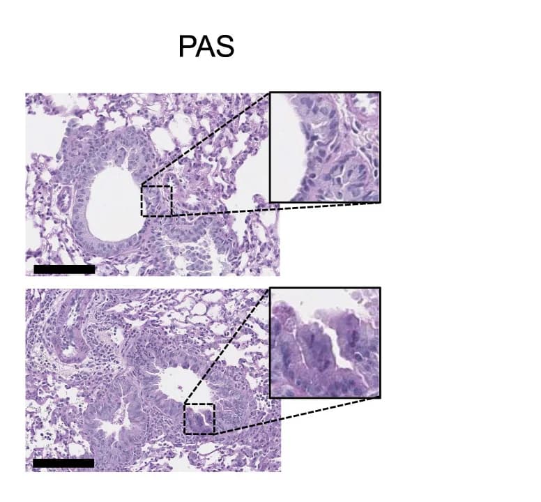 Open access visualization of Microscopy, Lung Histology, Vehicle Control, RTX, ALT