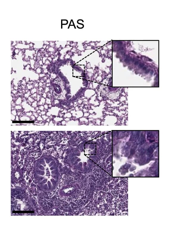 Open access visualization of Microscopy, Lung Histology, Control Mice, Jak1neuron Mice, Intranasal ALT