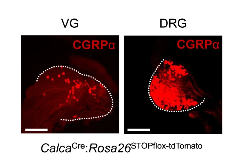 Open access visualization of Microscopy, Neuropeptides, CGRPa, CGRP, VG