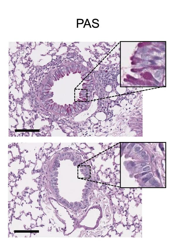 Open access visualization of Microscopy, Lung Histology, Intranasal ALT, AAV-Cre Control, AAV-Cre/JAK1GoF Infection