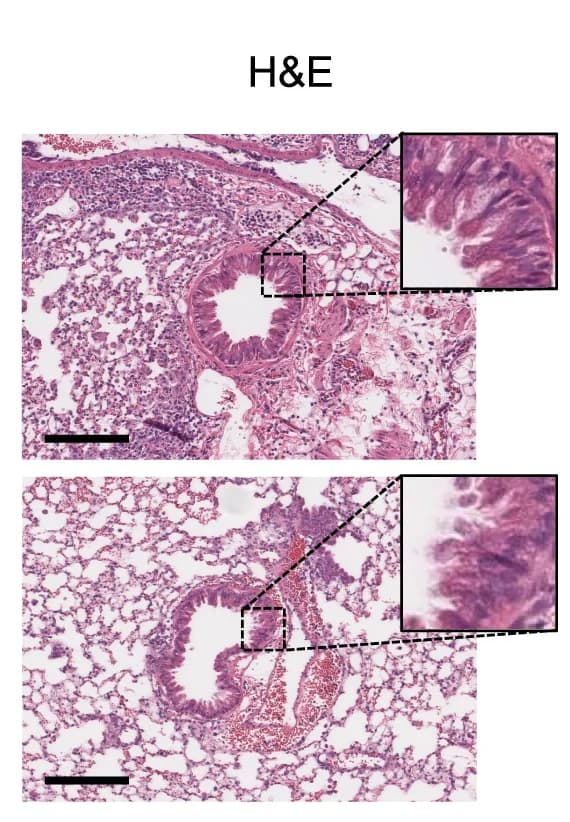 Open access visualization of Microscopy, Lung Histology, Intranasal ALT, H&E Stain