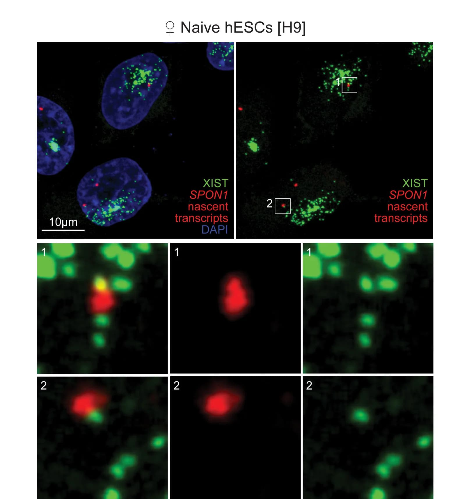 Open access visualization of Microscopy, RNA FISH, SPON1, Nascent Transcripts, XIST
