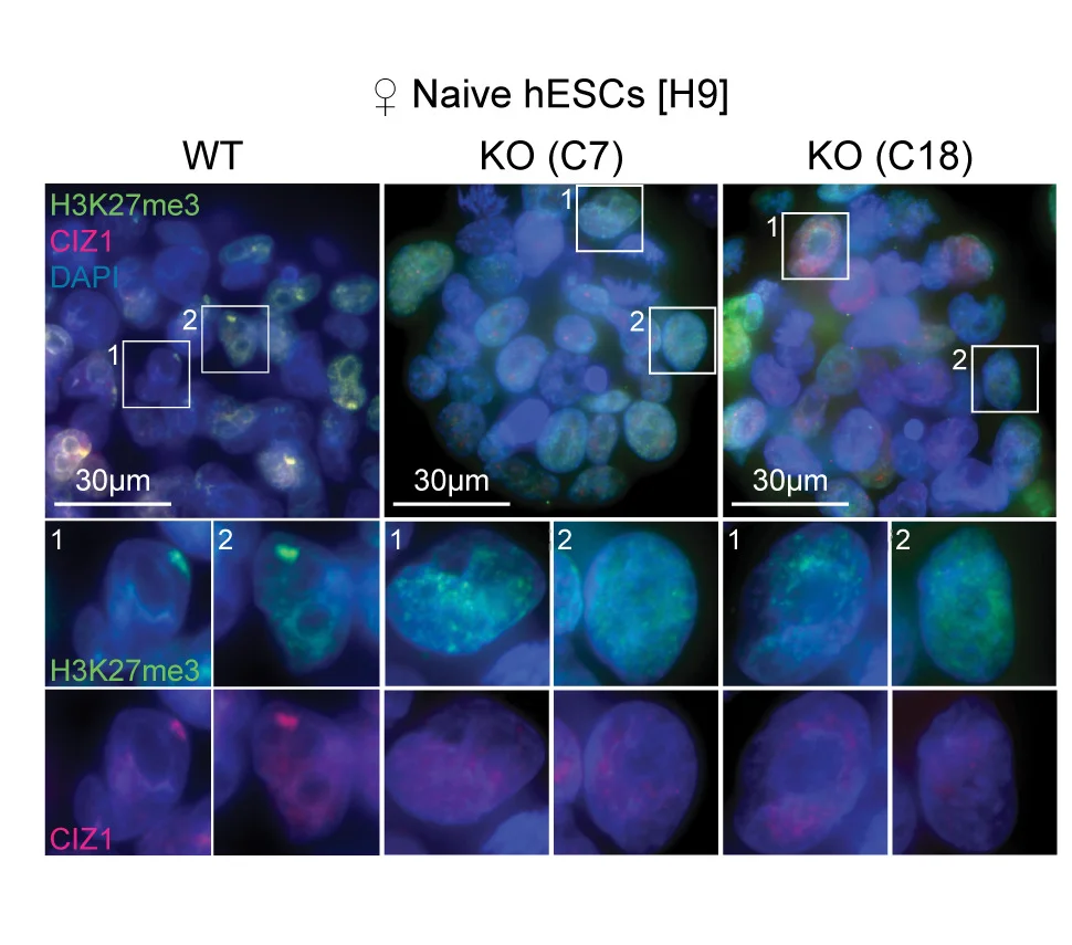 Open access visualization of Microscopy, H3K27me3, CIZ1, Immunostainings, Naive WT