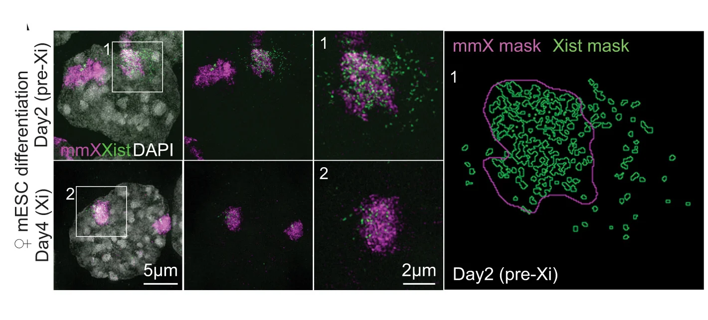 Open access visualization of Microscopy, 3D-Structured Illumination Microscopy, RNA-FISH, Xist, ChrX