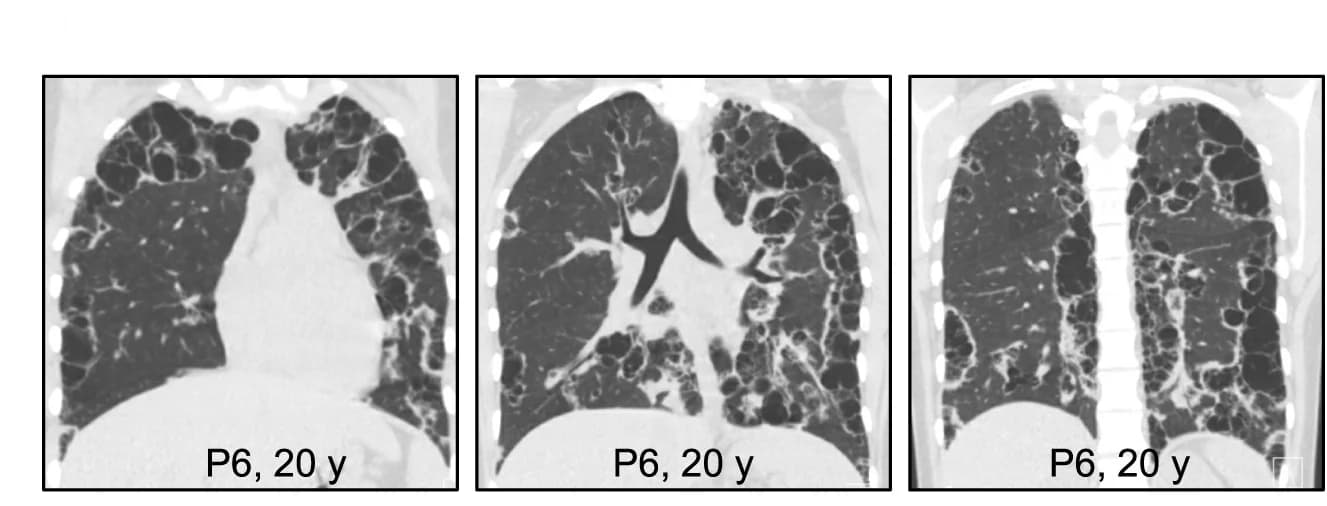 Open access visualization of Photo, CT Scan