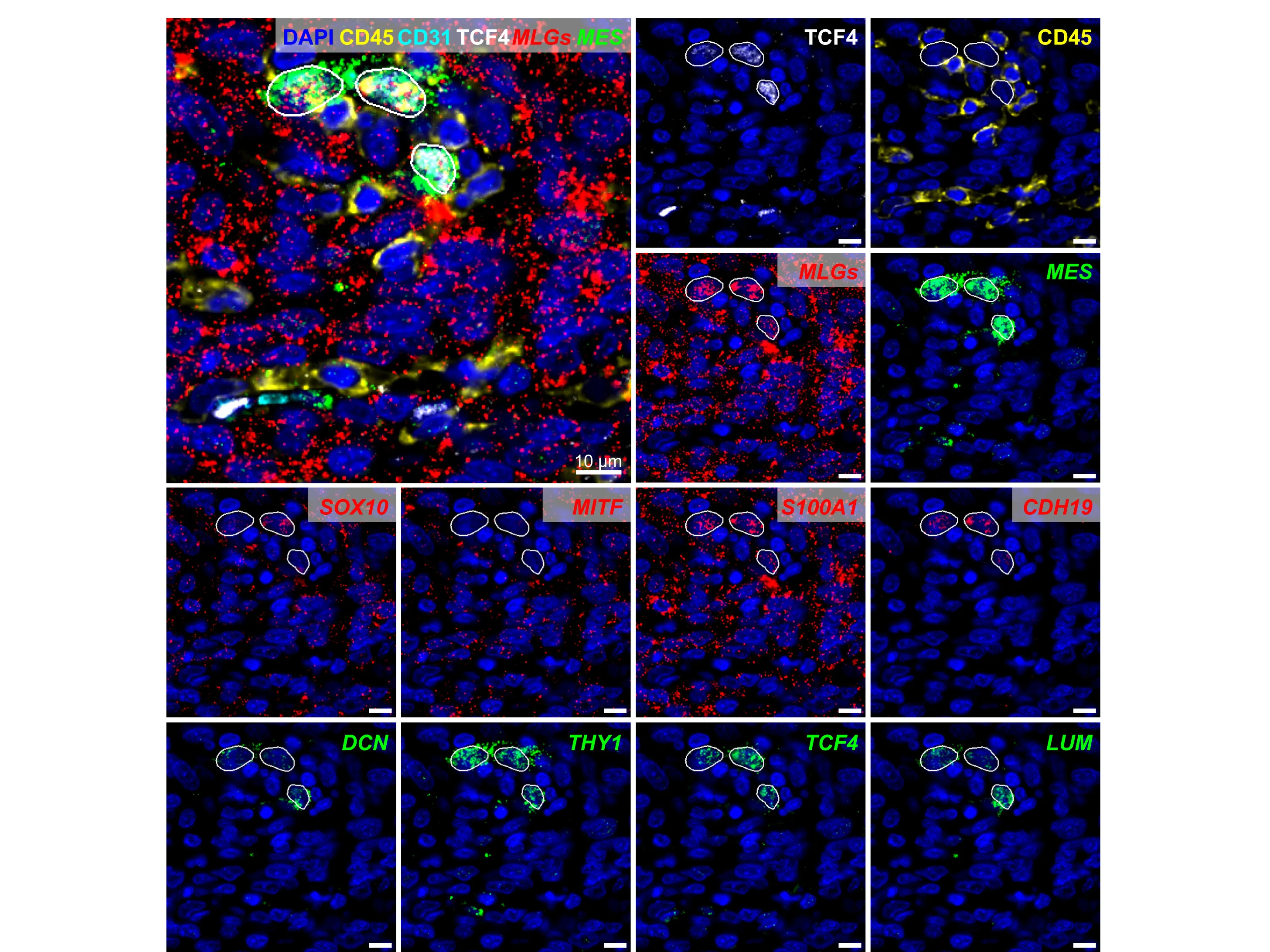 Open access visualization of Microscopy, Multiplex Immunostaining, CODEX, RNAscope, Lymph Node Metastasis