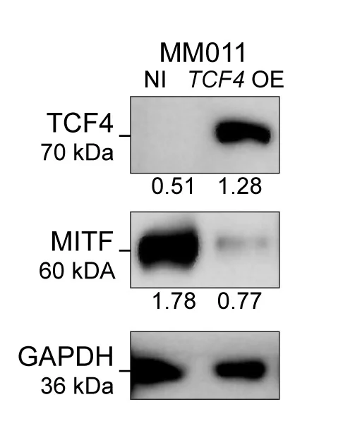 Open access visualization of Gel, Western Blot, TCF4, MITF, Protein Levels
